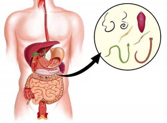 Nemanex eliminates parasites