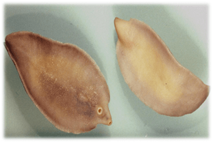 Fascia disease